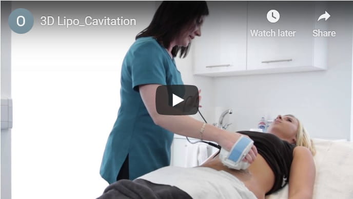 Cavitation Treatment